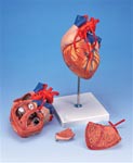 Heart Anatomy with Bypass, 2 times life size, 4 part model